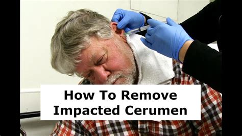 how to treat impacted cerumen